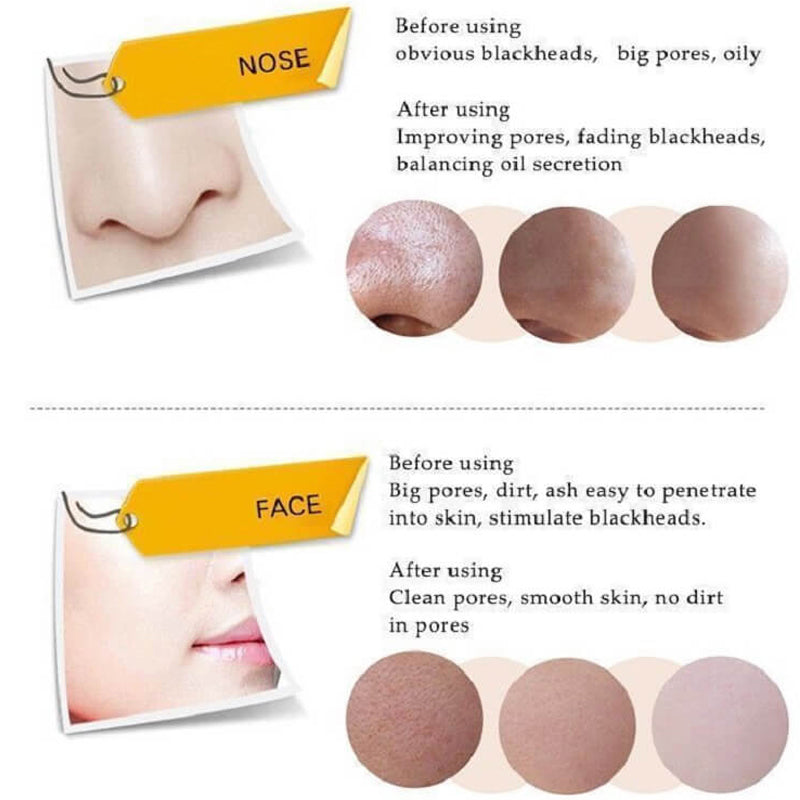 (BQY5662) Activated Blackhead Removal Bamboo Charcoal Black Facial Mask