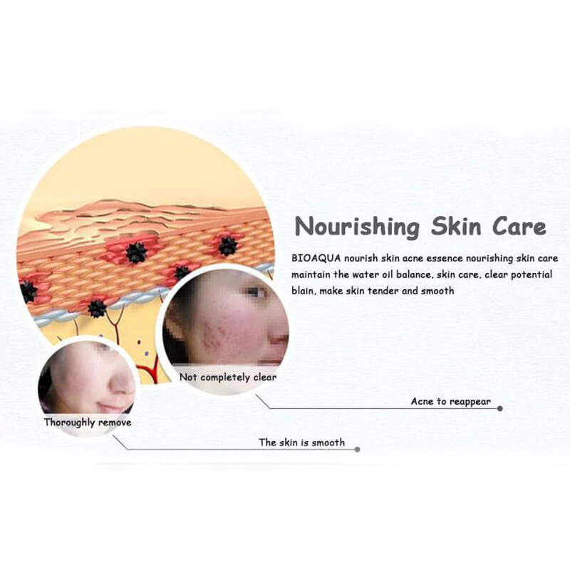 PURE SKIN Acne Brightening & Best Solution - Removal Of Acne Liquid - BIOAQUA® OFFICIAL STORE