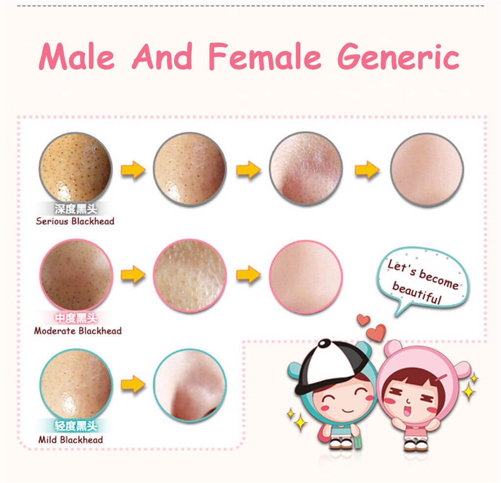 3 Step Pig Nose Blackhead Acne Remover Mask - BIOAQUA® OFFICIAL STORE