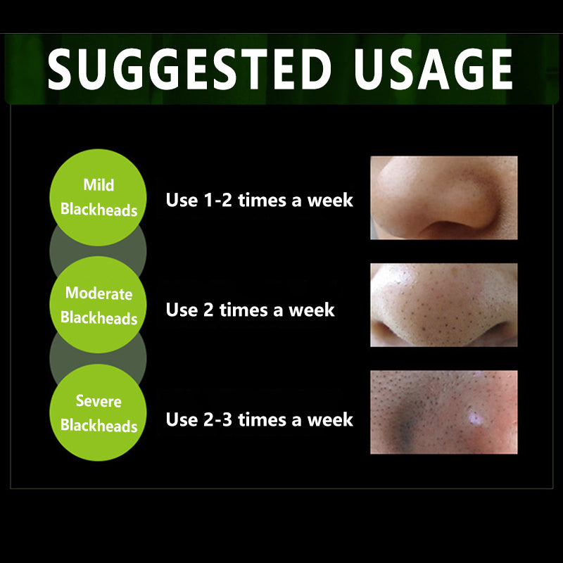 (BQY5662) Activated Blackhead Removal Bamboo Charcoal Black Facial Mask