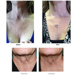 Crema reparadora para el cuello con colágeno