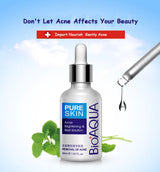 Solution pour peaux à imperfections