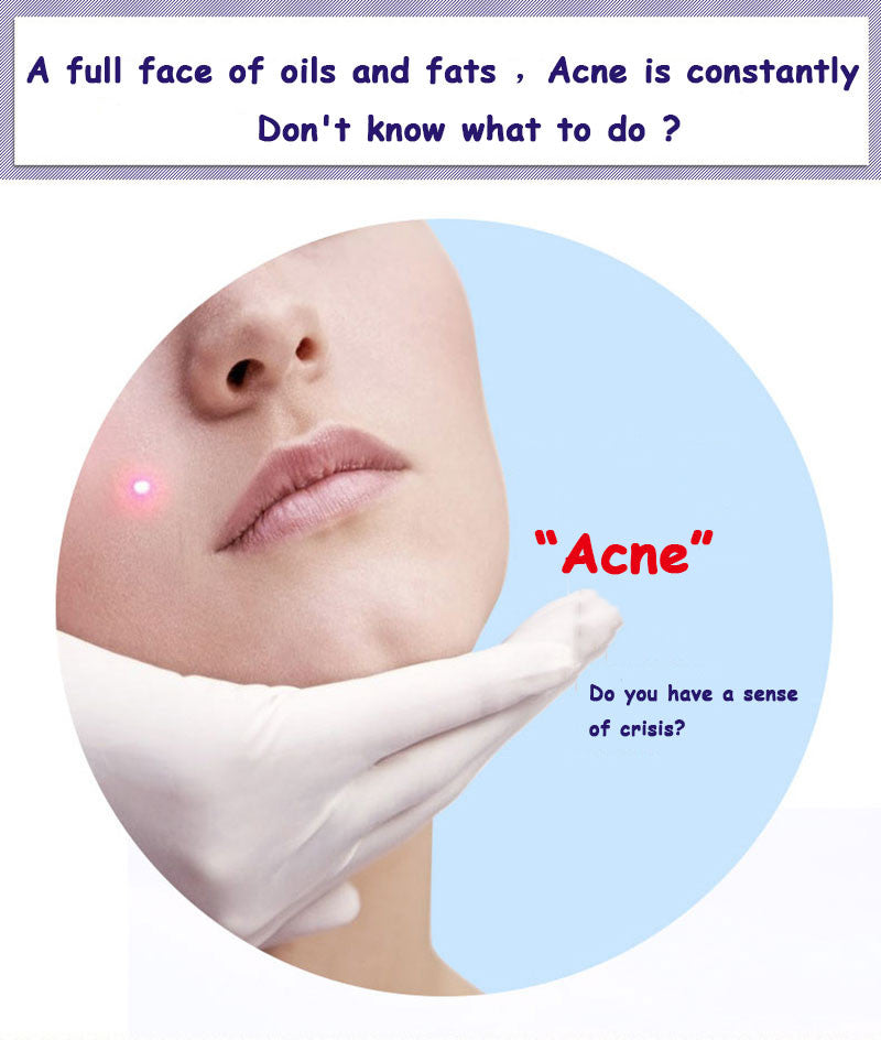 PURE SKIN Acne Brightening & Best Solution - Removal Of Acne Liquid - BIOAQUA® OFFICIAL STORE