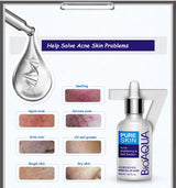 Solution pour peaux à imperfections