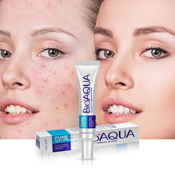 PURE SKIN Acne Scar Removal Rejuvenation Cream + Moisturizing Mask - BIOAQUA® OFFICIAL STORE